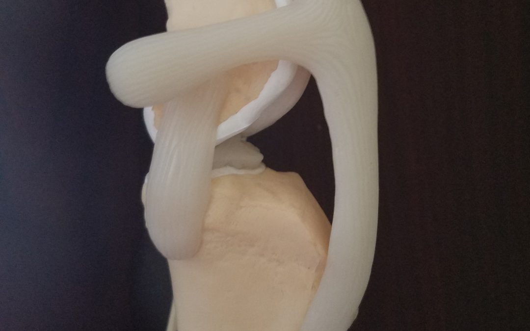 Knee Health – Prt II